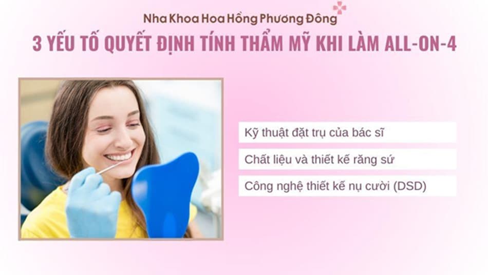 All-on-4 là phương pháp phục hình khó yêu cầu sự tỉ mỉ và tay nghề cao