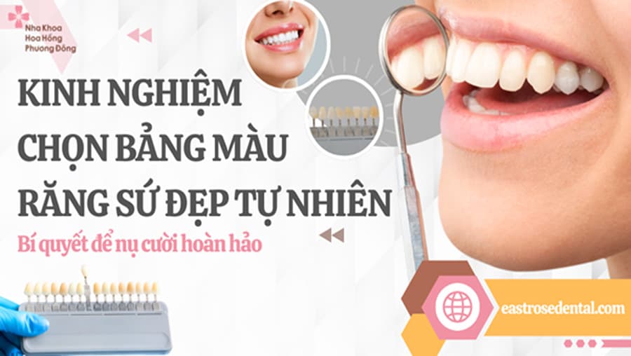 kinh nghiệm chọn màu răng sứ đẹp tự nhiên từ các chuyên gia tại Nha khoa Hoa Hồng Phương Đông
