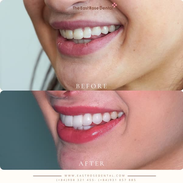 The secret power of Eastern facial harmony