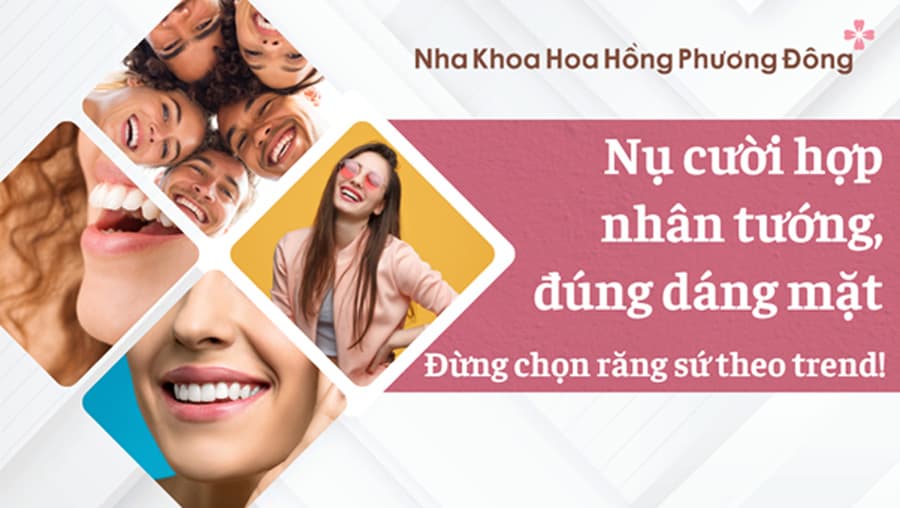 Nụ cười hợp nhân tướng, đúng dáng mặt: Đừng chọn răng sứ theo trend!