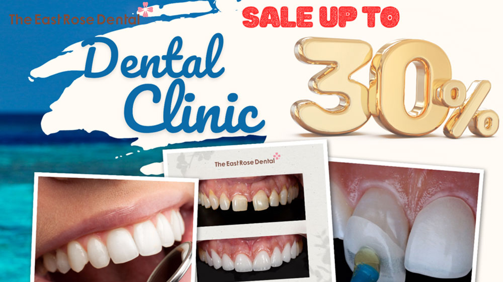 30% off in the summer of 2023 with porcelain crowns at East Rose Dental Clinic