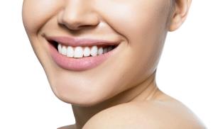 At-home teeth whitening – should you do it?