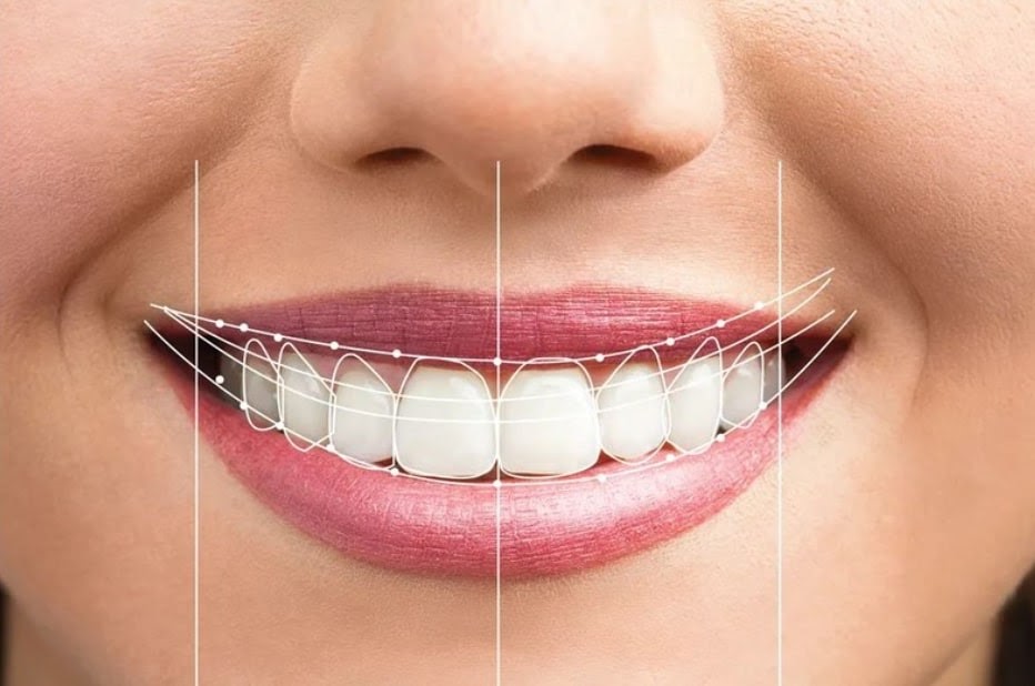 Overview of gummy smile treatment - Does it affect health?