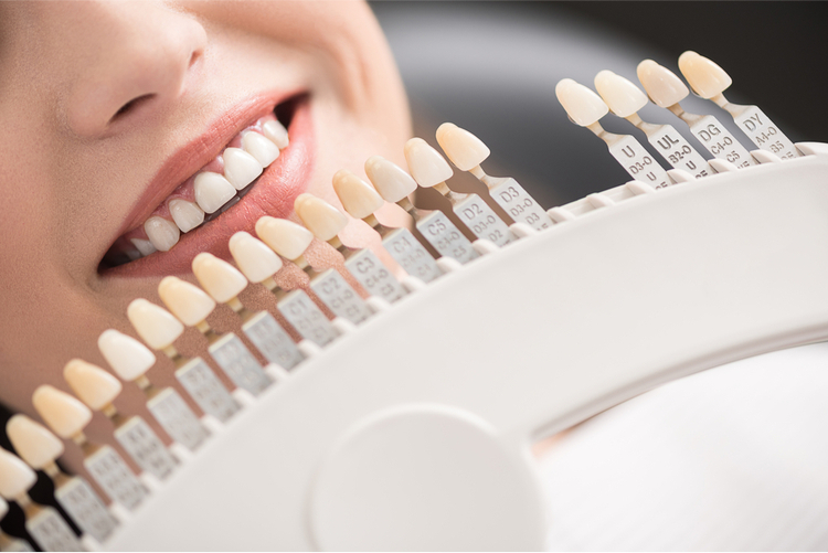 What you should know about dental crown procedure