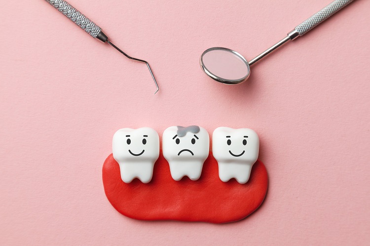 Phương pháp điều trị hiệu quả khi bị gãy răng