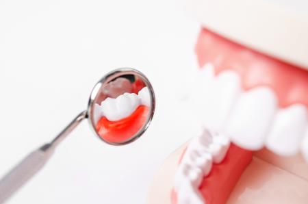 Gingivitis: Causes and Treatment
